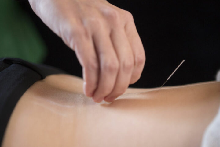 Acupuncture-Tao of Healing